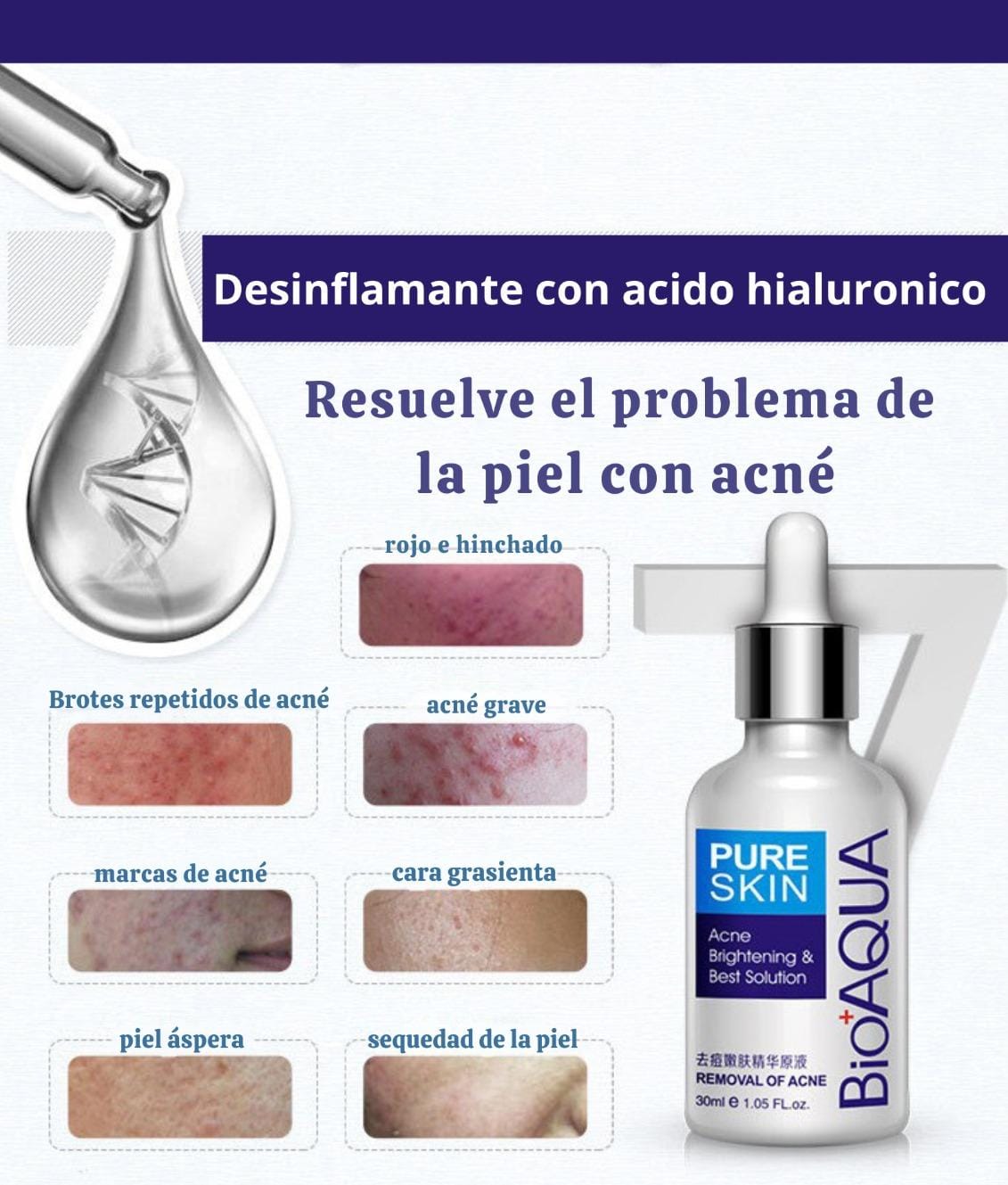 Serum antiacné y Acido Hialurónico | BIOAQUA™