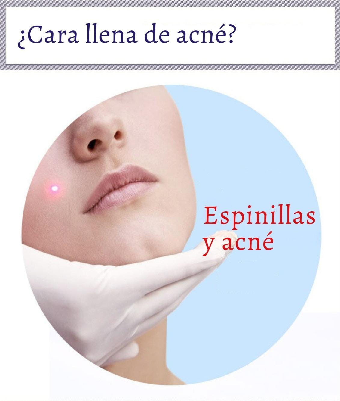 Serum antiacné y Acido Hialurónico | BIOAQUA™